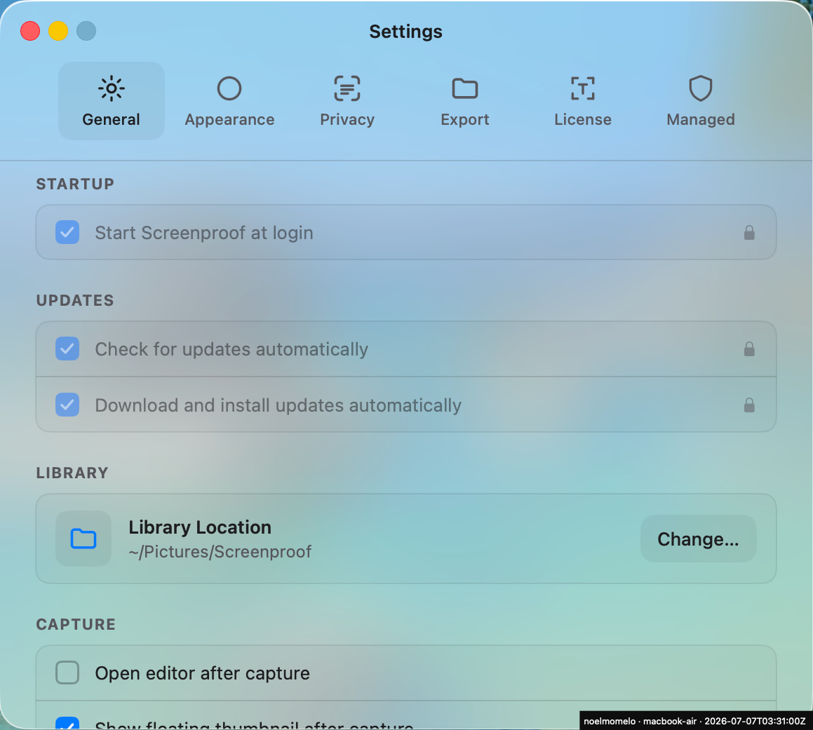Settings, General tab: automatic-update rows checked and locked by the profile